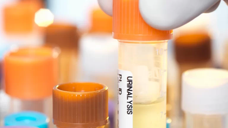 Stay informed and prepared: must-have products for urine drug testing